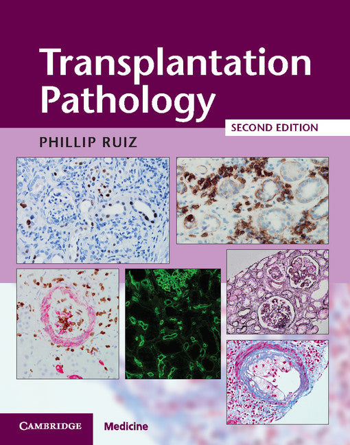 Transplantation Pathology Hardback with Online Resource (Multiple-component retail product) 9781107443280
