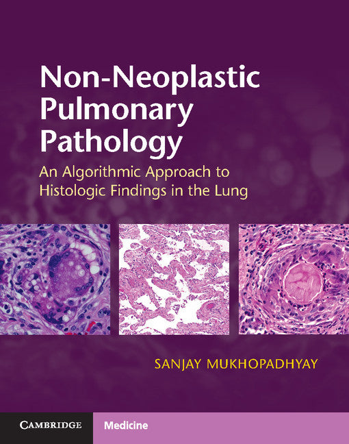 Non-Neoplastic Pulmonary Pathology with Online Resource; An Algorithmic Approach to Histologic Findings in the Lung (Multiple-component retail product) 9781107443501
