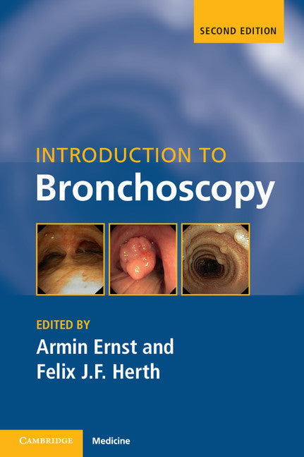 Introduction to Bronchoscopy (Paperback / softback) 9781107449527