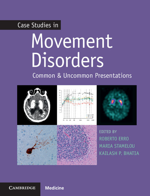 Case Studies in Movement Disorders; Common and Uncommon Presentations (Paperback / softback) 9781107472426