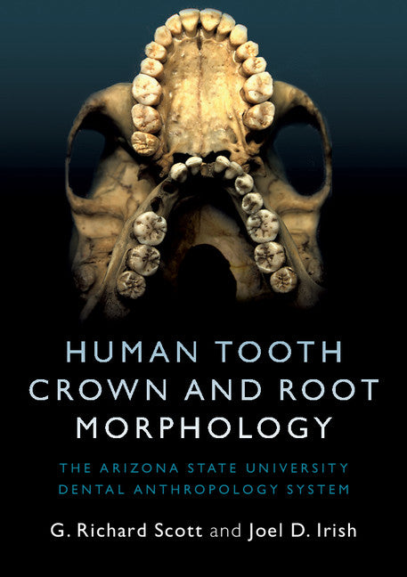 Human Tooth Crown and Root Morphology; The Arizona State University Dental Anthropology System (Paperback / softback) 9781107480735