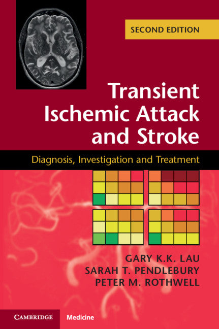 Transient Ischemic Attack and Stroke (Paperback / softback) 9781107485358