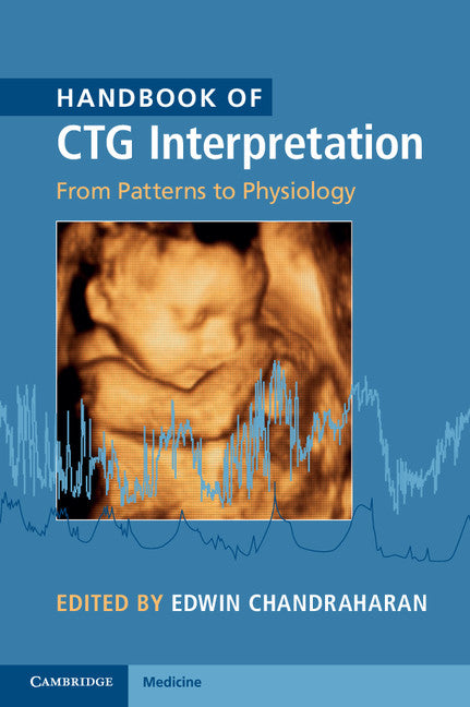 Handbook of CTG Interpretation; From Patterns to Physiology (Paperback / softback) 9781107485501