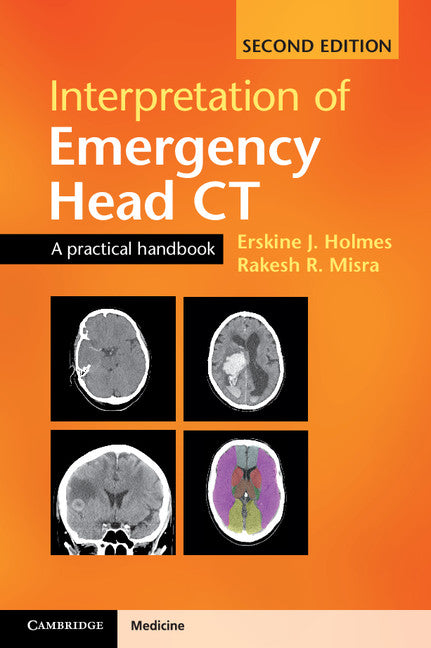 Interpretation of Emergency Head CT; A Practical Handbook (Paperback / softback) 9781107495937