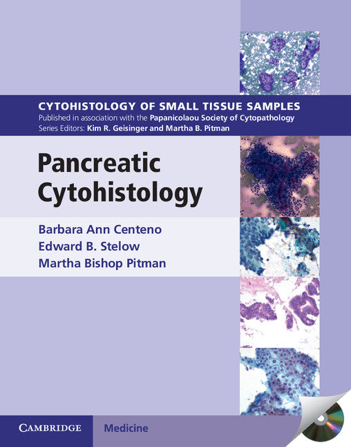 Pancreatic Cytohistology (Multiple-component retail product, part(s) enclosed) 9781107518308