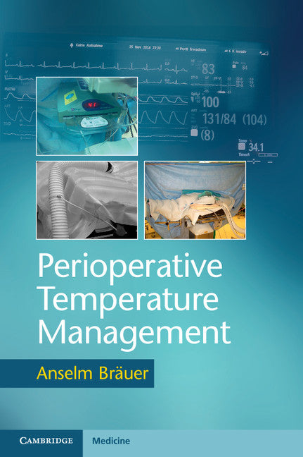 Perioperative Temperature Management (Paperback / softback) 9781107535770