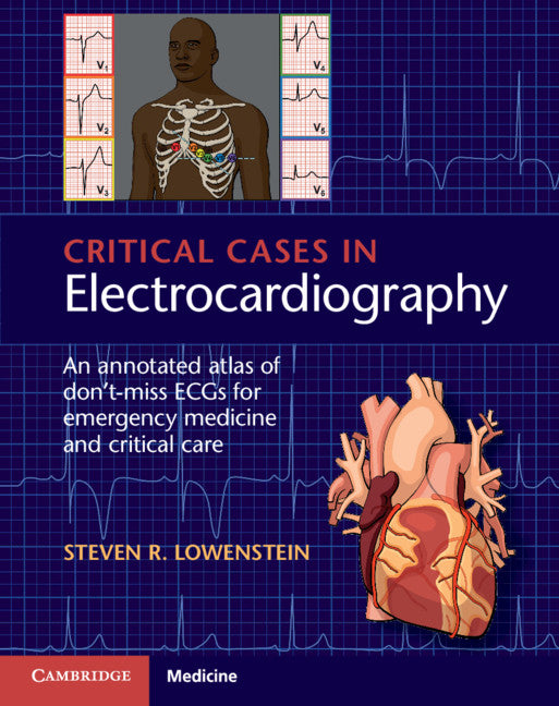 Critical Cases in Electrocardiography; An Annotated Atlas of Don't-Miss ECGs for Emergency Medicine and Critical Care (Paperback / softback) 9781107535916