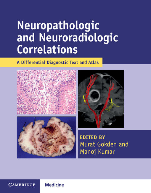 Neuropathologic and Neuroradiologic Correlations; A Differential Diagnostic Text and Atlas (Multiple-component retail product) 9781107567252