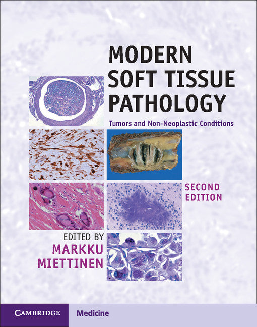 Modern Soft Tissue Pathology; Tumors and Non-Neoplastic Conditions (Multiple-component retail product) 9781107567276