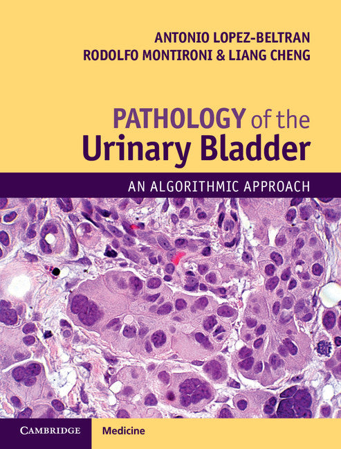 Pathology of the Urinary Bladder; An Algorithmic Approach (Multiple-component retail product) 9781107593374