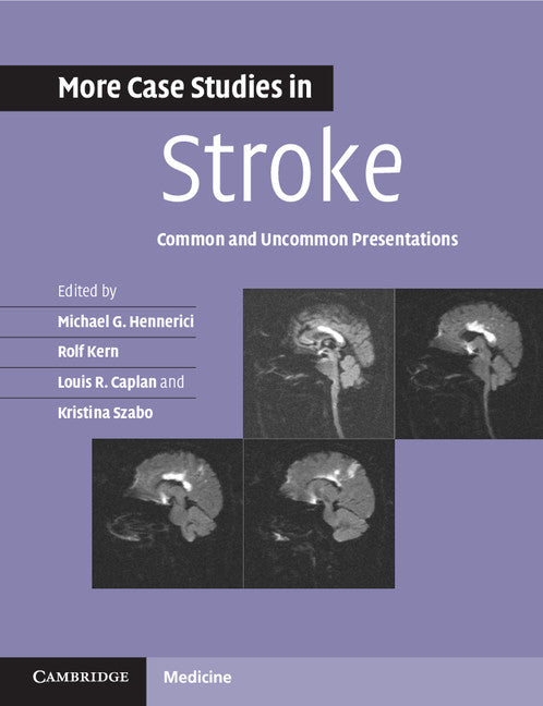 More Case Studies in Stroke; Common and Uncommon Presentations (Paperback / softback) 9781107610033