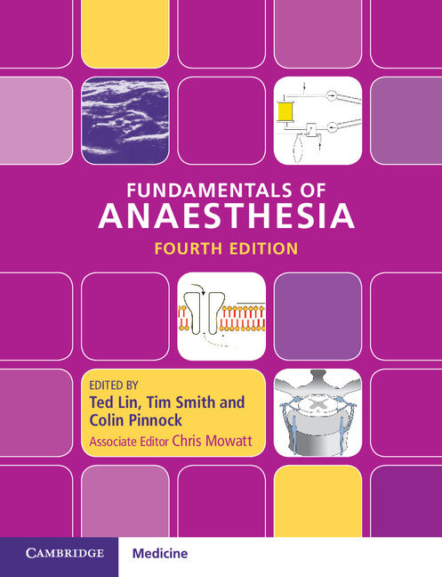 Fundamentals of Anaesthesia (Paperback / softback) 9781107612389