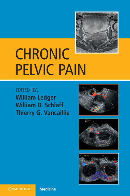 Chronic Pelvic Pain (Paperback / softback) 9781107636620