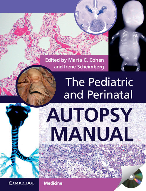 The Pediatric and Perinatal Autopsy Manual with DVD-ROM (Multiple-component retail product, part(s) enclosed) 9781107646070