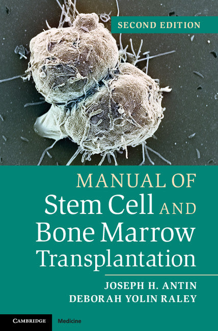 Manual of Stem Cell and Bone Marrow Transplantation (Paperback / softback) 9781107661547