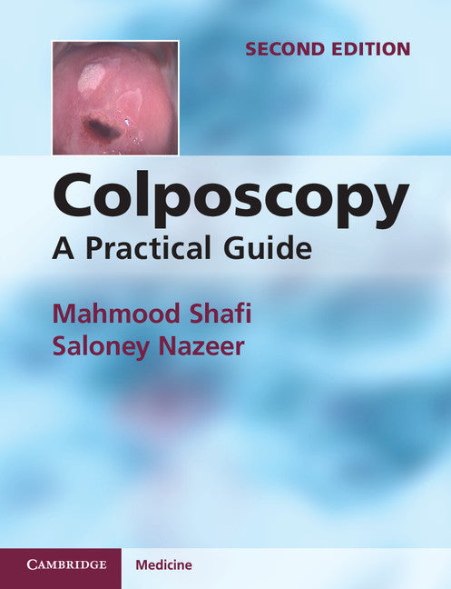 Colposcopy; A Practical Guide (Paperback / softback) 9781107667822