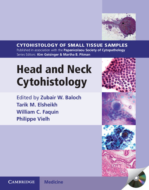 Head and Neck Cytohistology with DVD-ROM (Multiple-component retail product, part(s) enclosed) 9781107669888