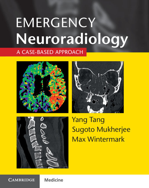 Emergency Neuroradiology; A Case-Based Approach (Paperback / softback) 9781107676138