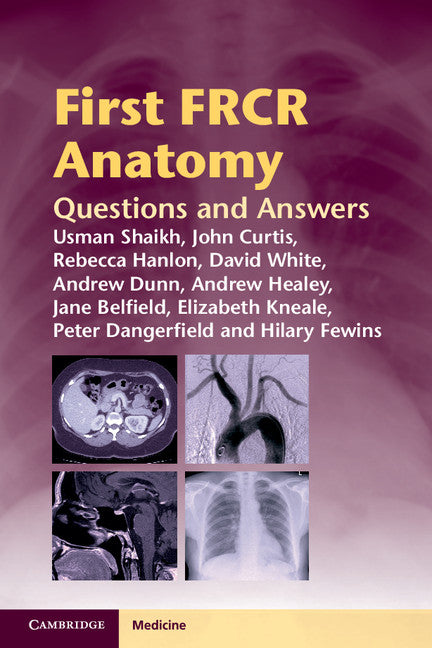 First FRCR Anatomy; Questions and Answers (Paperback / softback) 9781107679498