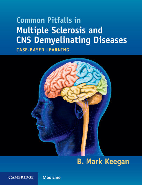 Common Pitfalls in Multiple Sclerosis and CNS Demyelinating Diseases; Case-Based Learning (Paperback / softback) 9781107680401