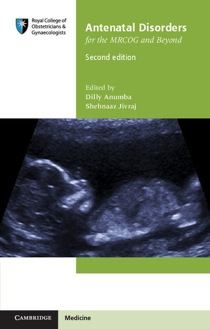 Antenatal Disorders for the MRCOG and Beyond (Paperback / softback) 9781107684928