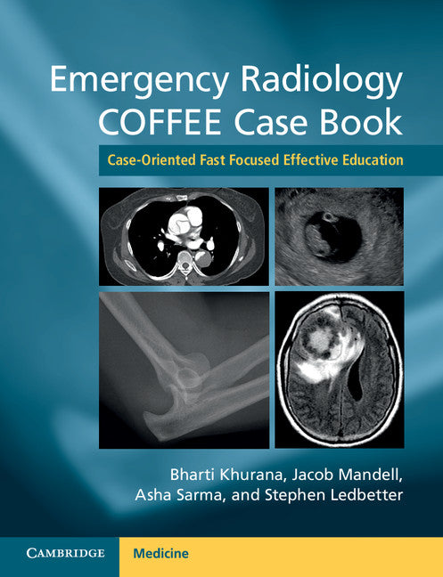 Emergency Radiology COFFEE Case Book; Case-Oriented Fast Focused Effective Education (Paperback / softback) 9781107690769