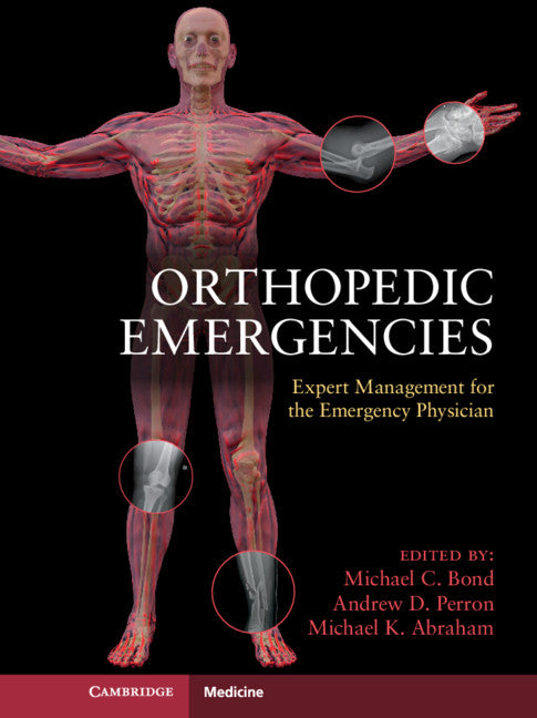 Orthopedic Emergencies; Expert Management for the Emergency Physician (Paperback / softback) 9781107696617