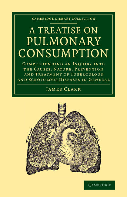 A Treatise on Pulmonary Consumption; Comprehending an Inquiry into the Causes, Nature, Prevention and Treatment of Tuberculous and Scrofulous Diseases in General (Paperback / softback) 9781108062305