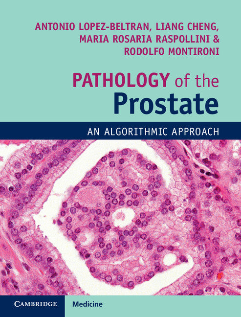 Pathology of the Prostate; An Algorithmic Approach (Multiple-component retail product) 9781108185653