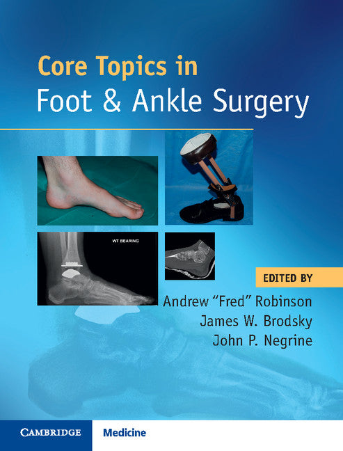 Core Topics in Foot and Ankle Surgery (Hardback) 9781108418935
