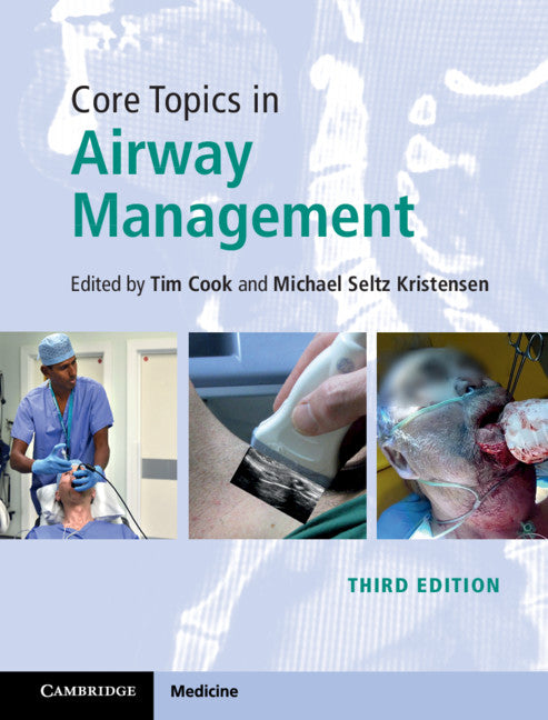 Core Topics in Airway Management (Hardback) 9781108419536