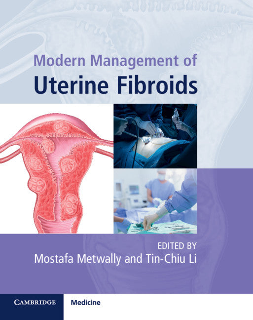 Modern Management of Uterine Fibroids (Hardback) 9781108420174