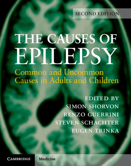 The Causes of Epilepsy; Common and Uncommon Causes in Adults and Children (Hardback) 9781108420754