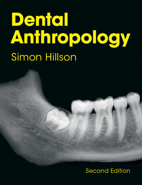 Dental Anthropology (Paperback / softback) 9781108433969