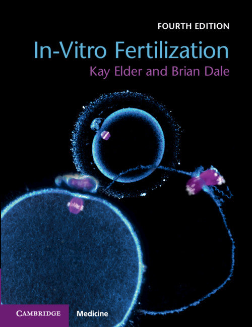 In-Vitro Fertilization (Paperback / softback) 9781108441810