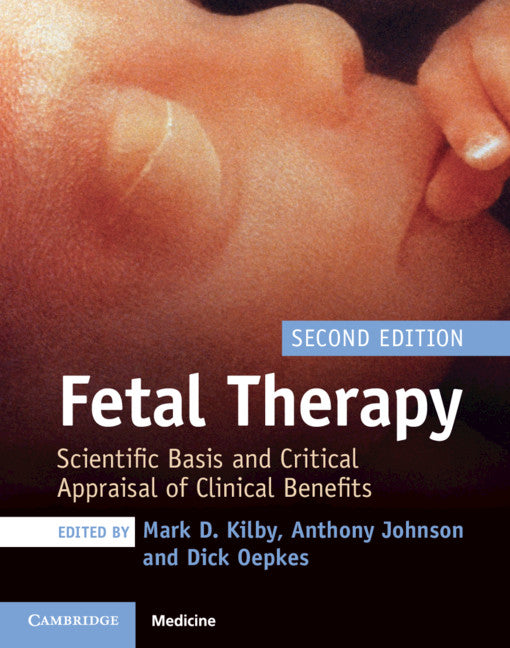 Fetal Therapy; Scientific Basis and Critical Appraisal of Clinical Benefits (Hardback) 9781108474061