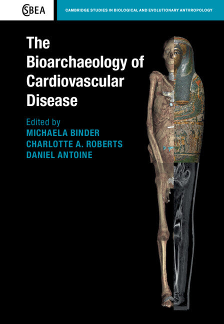 The Bioarchaeology of Cardiovascular Disease (Hardback) 9781108480345