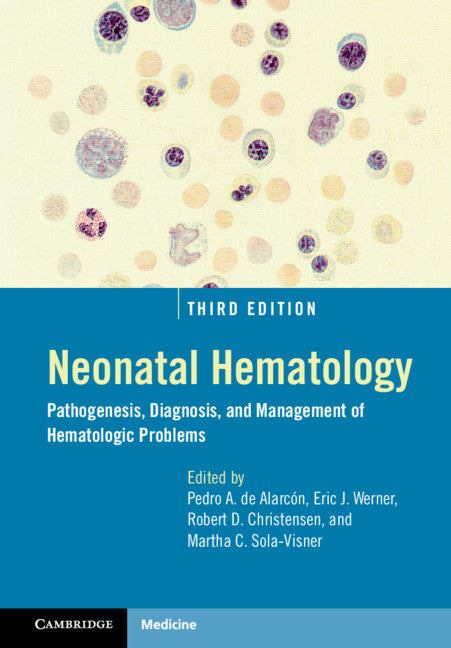 Neonatal Hematology; Pathogenesis, Diagnosis, and Management of Hematologic Problems (Hardback) 9781108488983