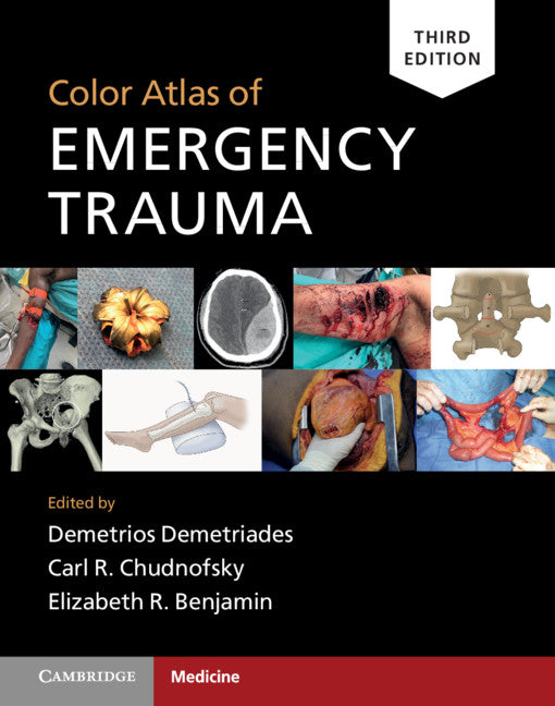 Color Atlas of Emergency Trauma (Hardback) 9781108489348