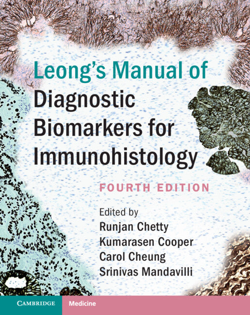 Leong's Manual of Diagnostic Biomarkers for Immunohistology (Hardback) 9781108491570