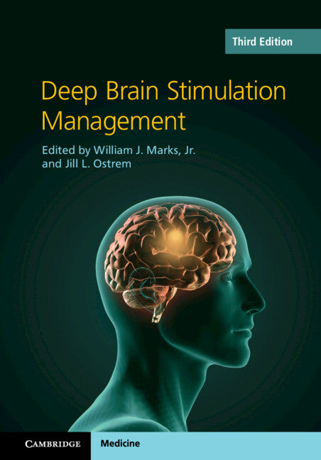 Deep Brain Stimulation Management (Hardback) 9781108494991