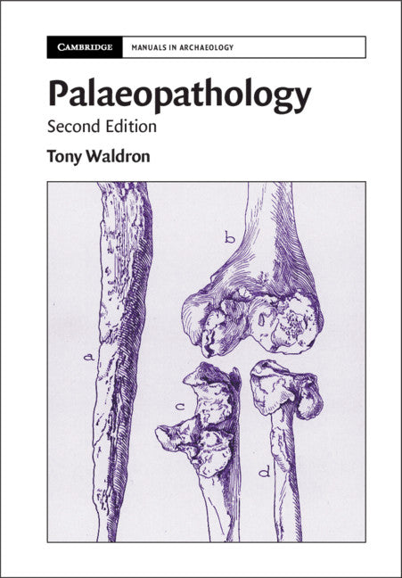 Palaeopathology (Hardback) 9781108499583