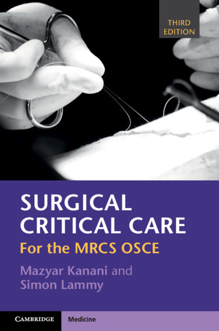 Surgical Critical Care; For the MRCS OSCE (Paperback / softback) 9781108702546