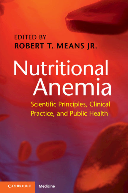 Nutritional Anemia; Scientific Principles, Clinical Practice, and Public Health (Paperback / softback) 9781108714303