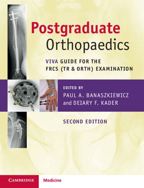 Postgraduate Orthopaedics; Viva Guide for the FRCS (Tr & Orth) Examination (Paperback / softback) 9781108722155