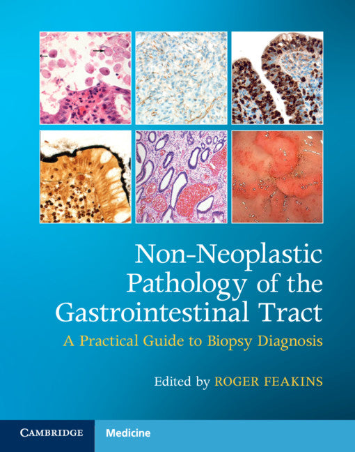 Non-Neoplastic Pathology of the Gastrointestinal Tract with Online Resource; A Practical Guide to Biopsy Diagnosis (Multiple-component retail product) 9781108766548