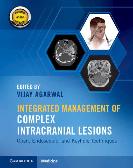 Integrated Management of Complex Intracranial Lesions Hardback Set and Static Online Product; Open, Endoscopic, and Keyhole Techniques (Multiple-component retail product) 9781108782838