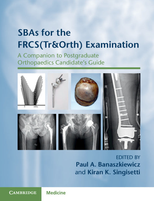 SBAs for the FRCS(Tr&Orth) Examination; A Companion to Postgraduate Orthopaedics Candidate's Guide (Paperback / softback) 9781108789974