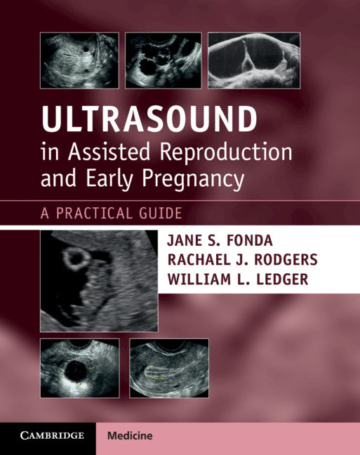 Ultrasound in Assisted Reproduction and Early Pregnancy; A Practical Guide (Paperback / softback) 9781108810210