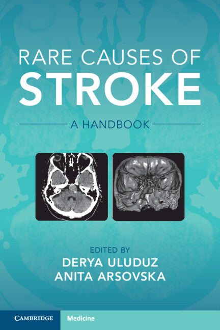 Rare Causes of Stroke; A Handbook (Paperback / softback) 9781108821254